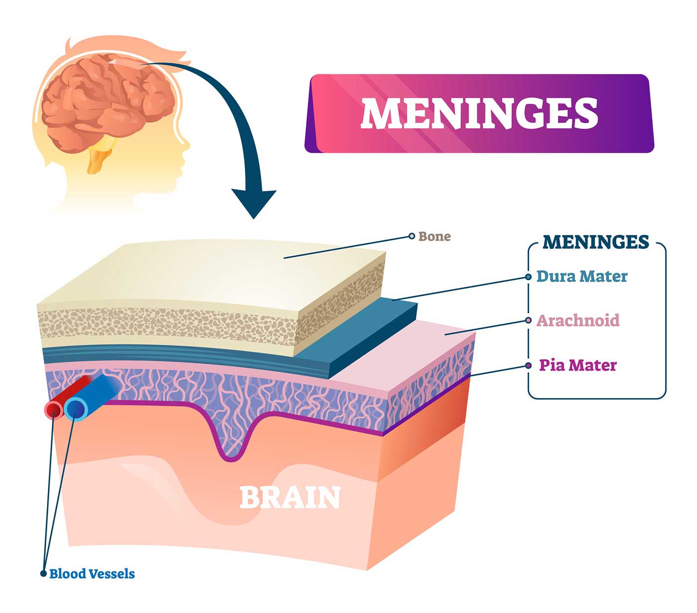 Three layers of the meninges beneath the skull: the outer dura mater, arachnoid and inner pia mater